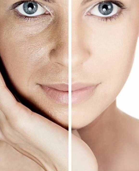Healthy vs Irritated Skin